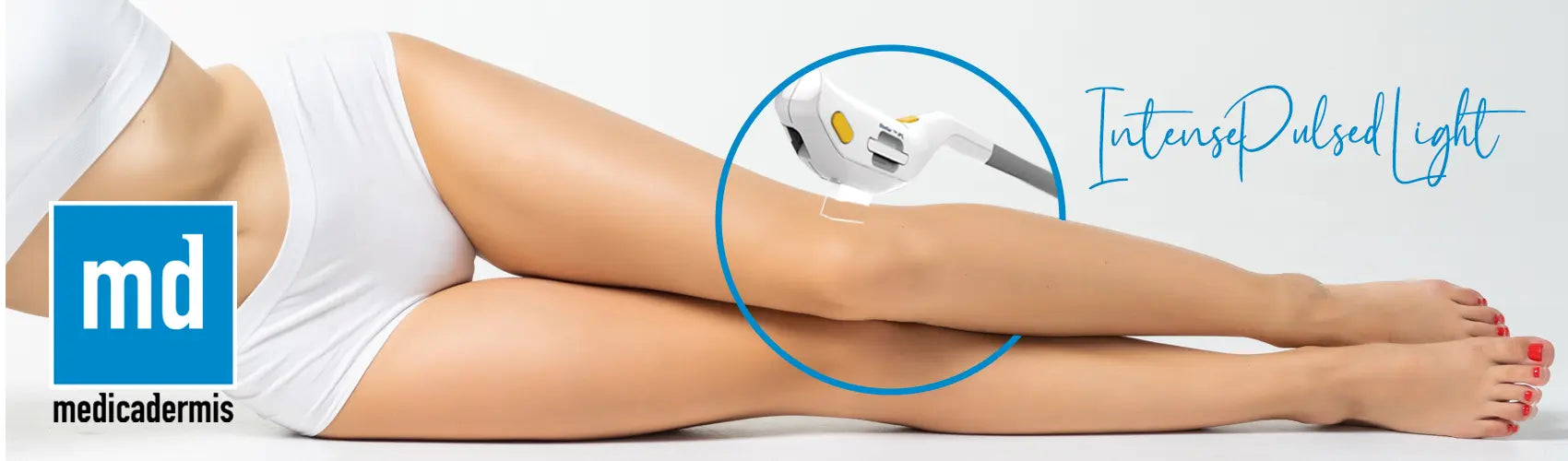 Intense Pulsed Light (IPL)