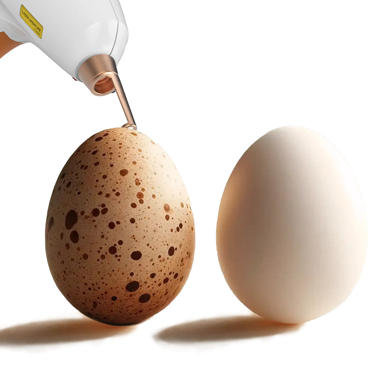 Medische Laser-therapie tegen pigmentvlekken en hyperpigmentatie